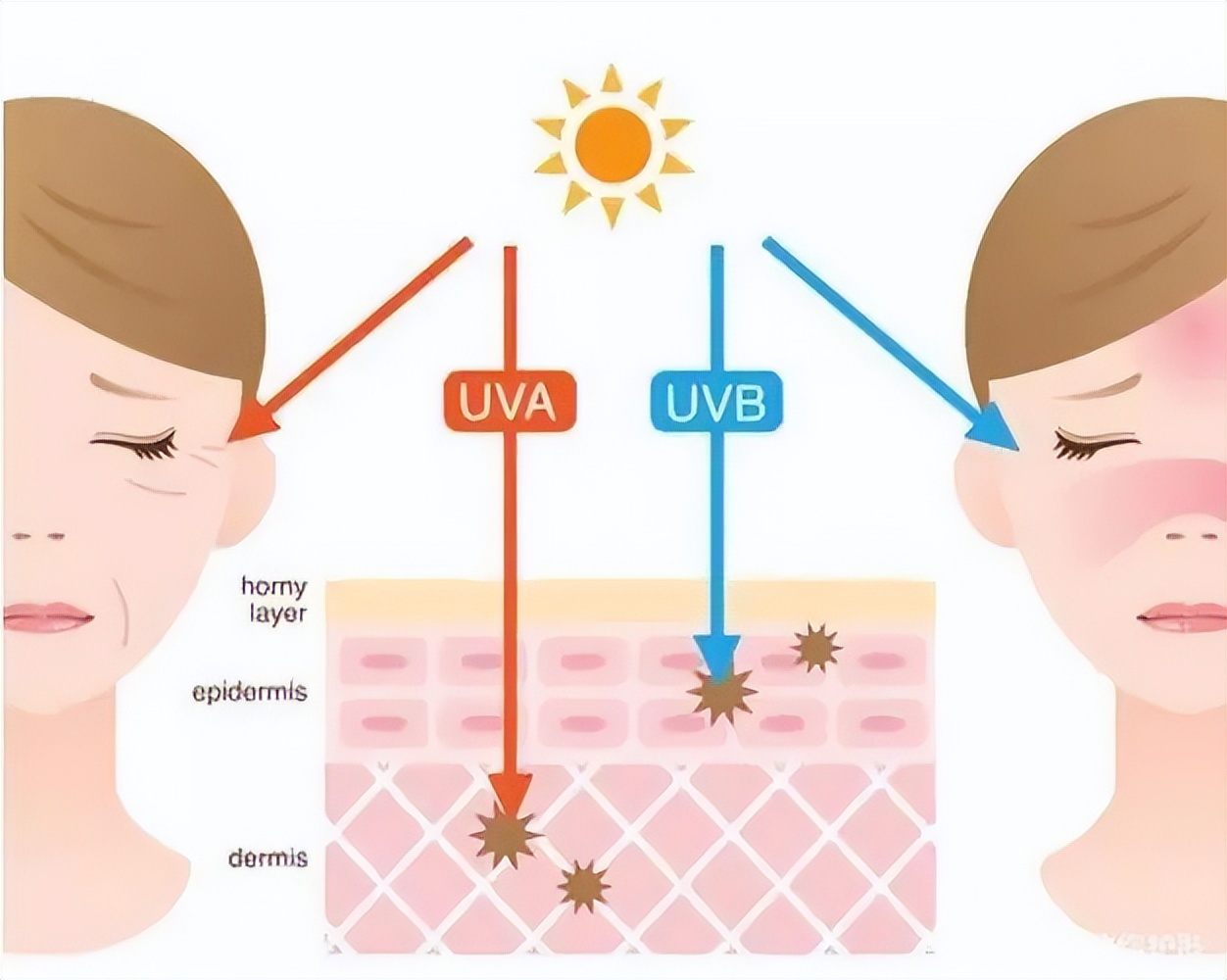 脸部泛红有红血丝怎样淡化,怎么改善脸上的红血丝