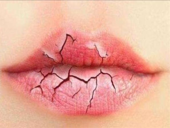 舌干舌燥中医治疗,舌干口燥津液少
