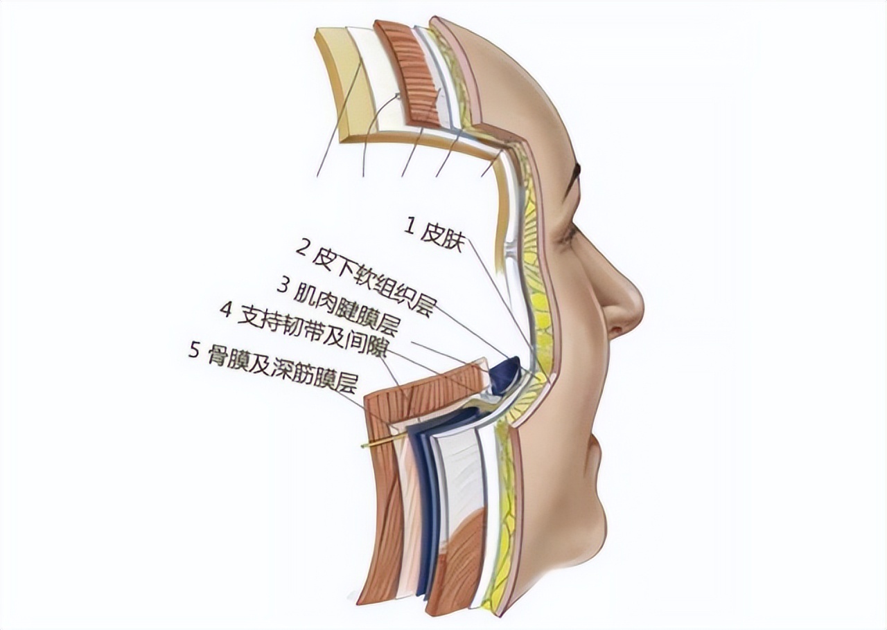 拉皮成功整容案例,拉皮提升面部手术对比图