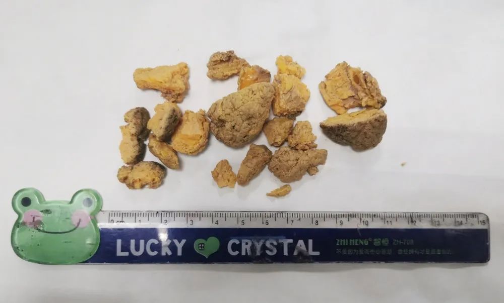 三岁孩童吃了一种水果中毒身亡,孩子吃了这种水果不幸离世