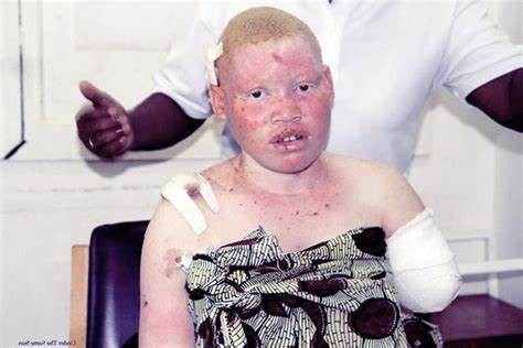 非洲版“唐僧”：血液堪比黄金遗骸可卖上百万，警方束手无策