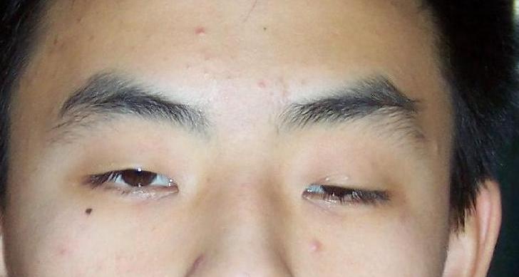 精虚腿无力，血虚眼无力，气虚身无力，中医三招，腿好身体棒！