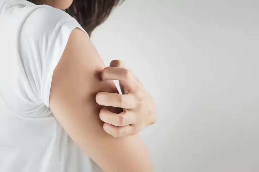 万能皮肤药“炉甘石洗剂”，能解决哪些皮肤问题？应注意些什么？