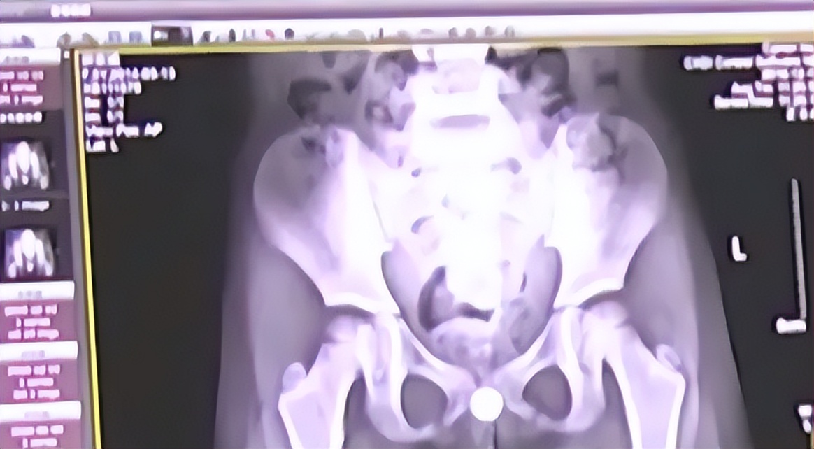 浙江6岁女童阴道内被这个小东西烧焦！祸因值得所有妈妈深思…