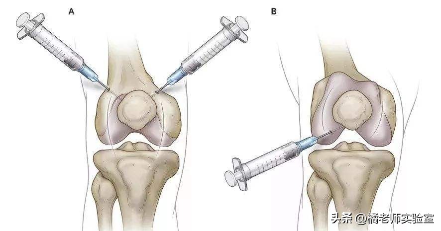 内马尔还能踢球么,内马尔以后还踢球吗