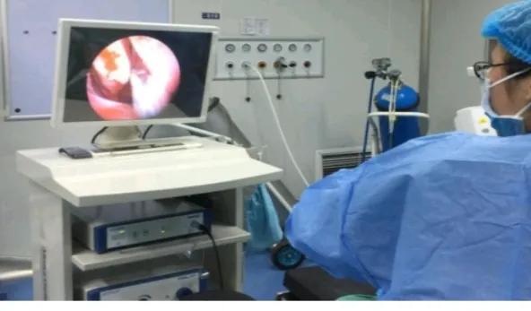 怎么治疗鼻出血,鼻出血介入治疗