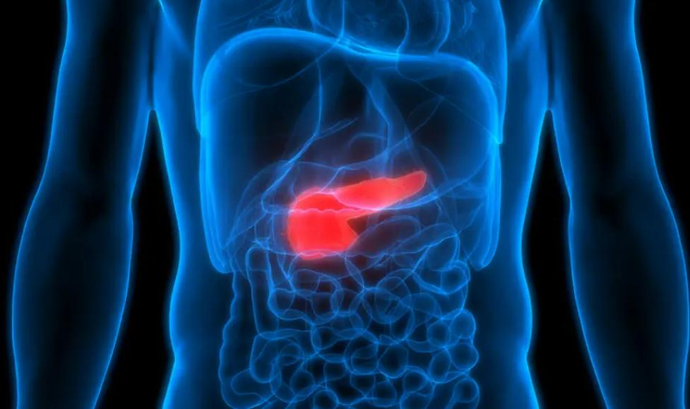 日本胰腺癌生存率多少,日本胰腺癌5年存活率