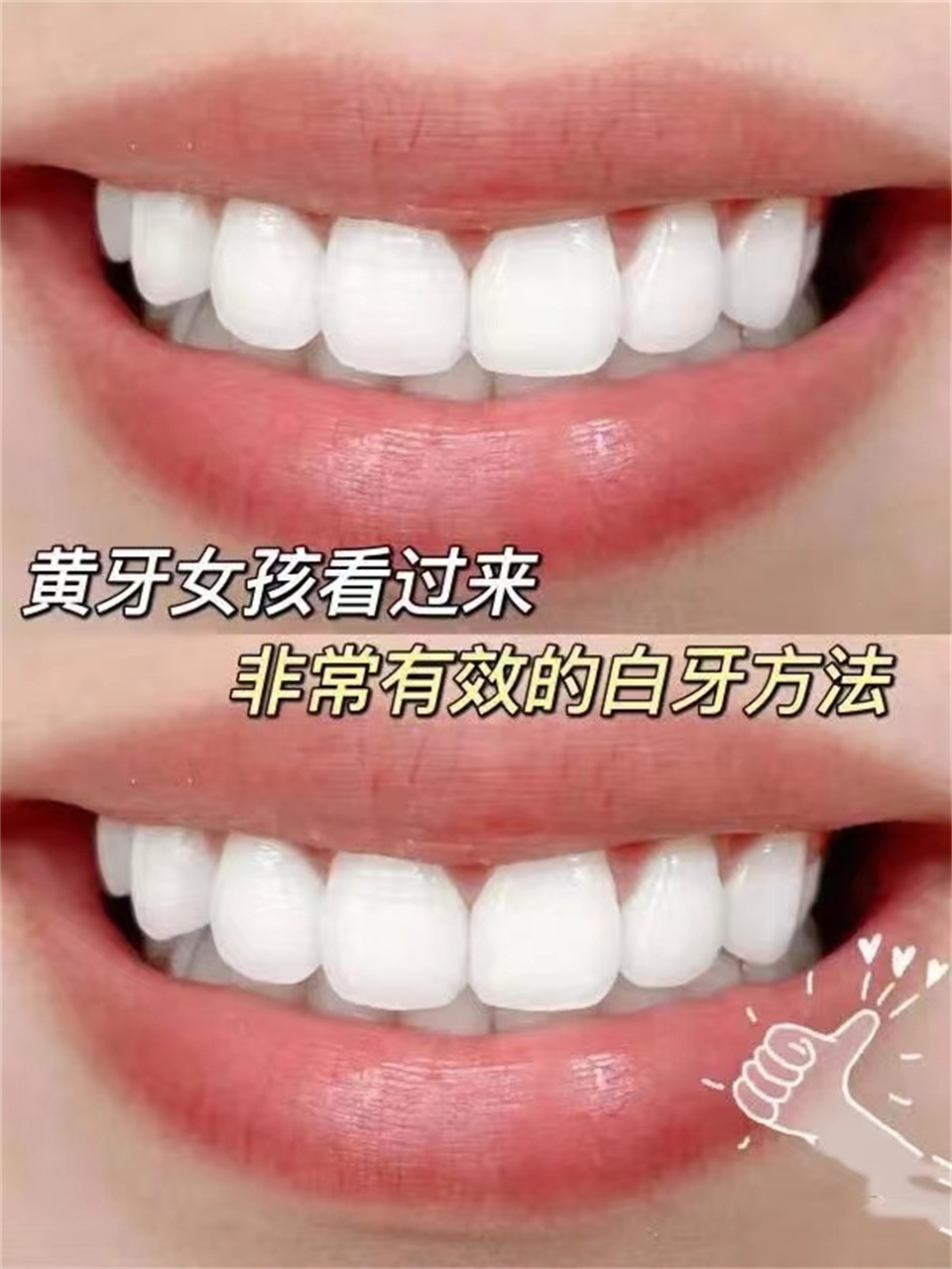 牙套清洁牙膏,戴牙套可以用牙粉吗