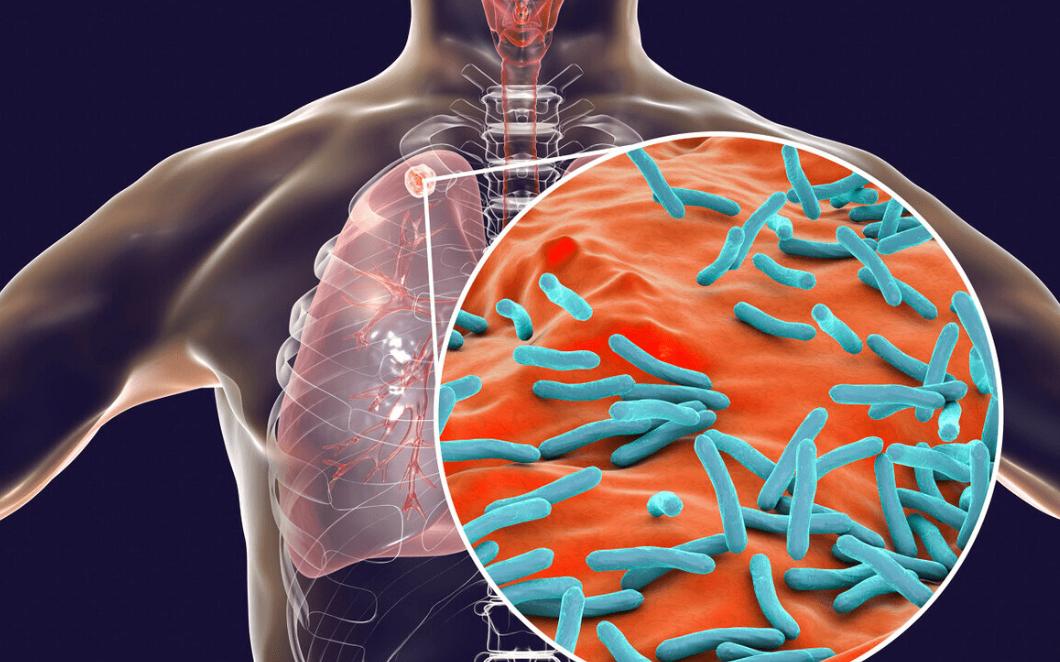 甲硝唑治什么最好,甲硝唑能摆平这四种病