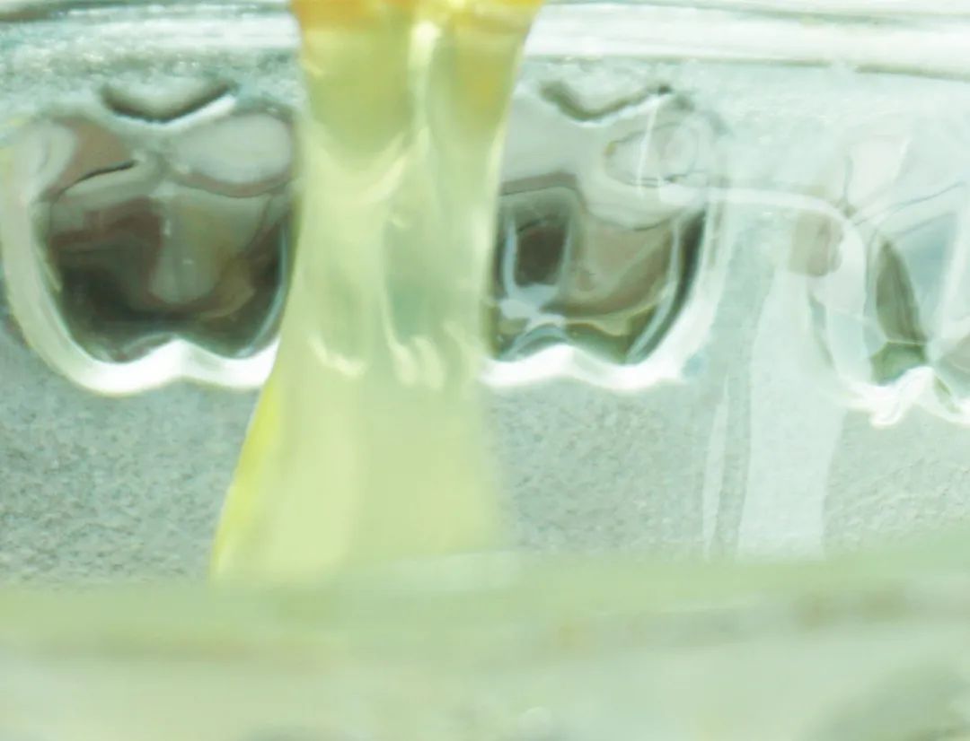 妇科白带水样带脓性怎么回事,如何分清是水样白带还是脓性白带