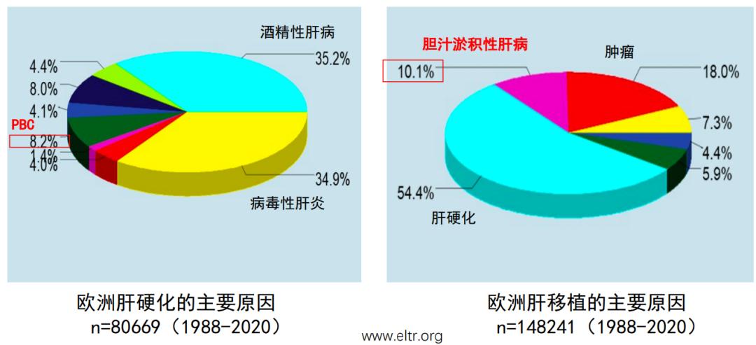 段维佳教授：谈肝论道，细说PBC与PSC的新药研发进展
