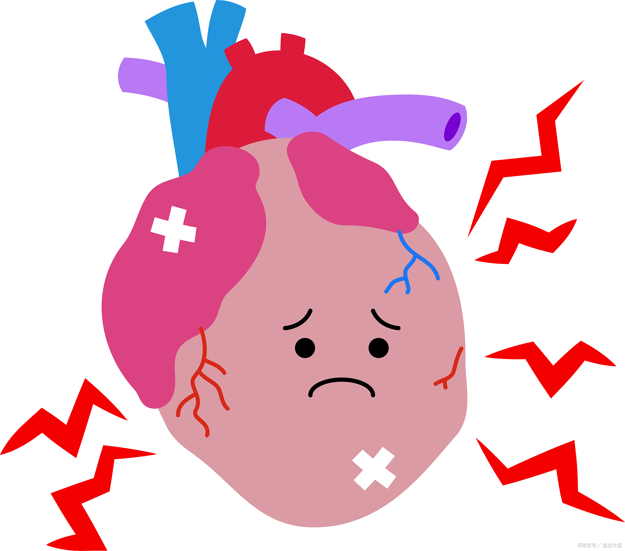 冠心病心悸心慌能吃丹参滴丸吗,冠心病心慌焦虑吃什么药可以缓解