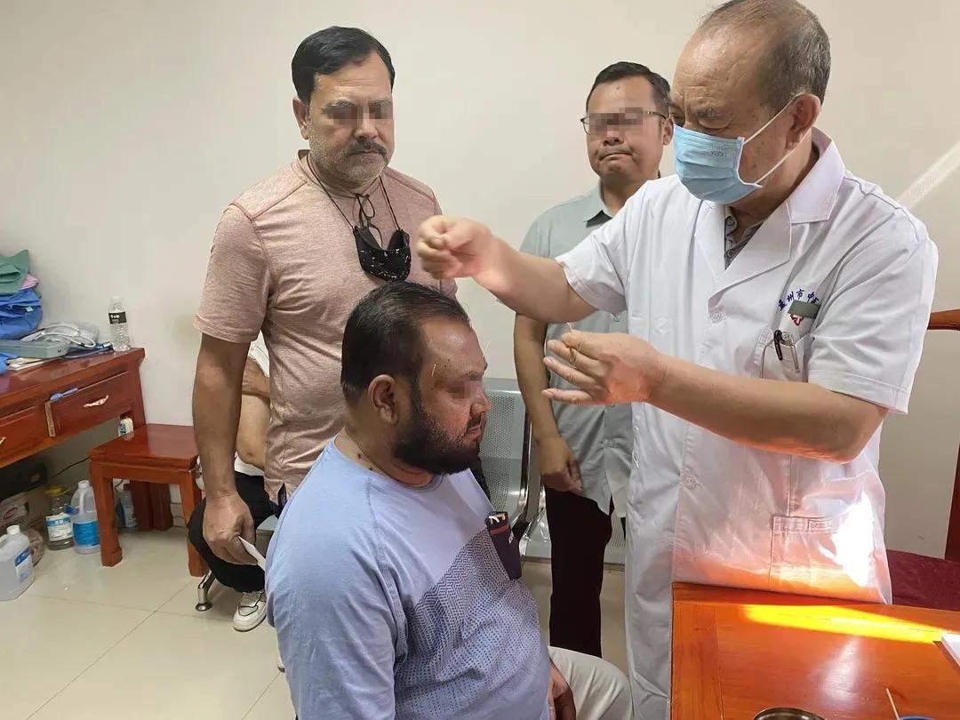 无国界医生针灸,中医针灸拯救国外瘫痪病人