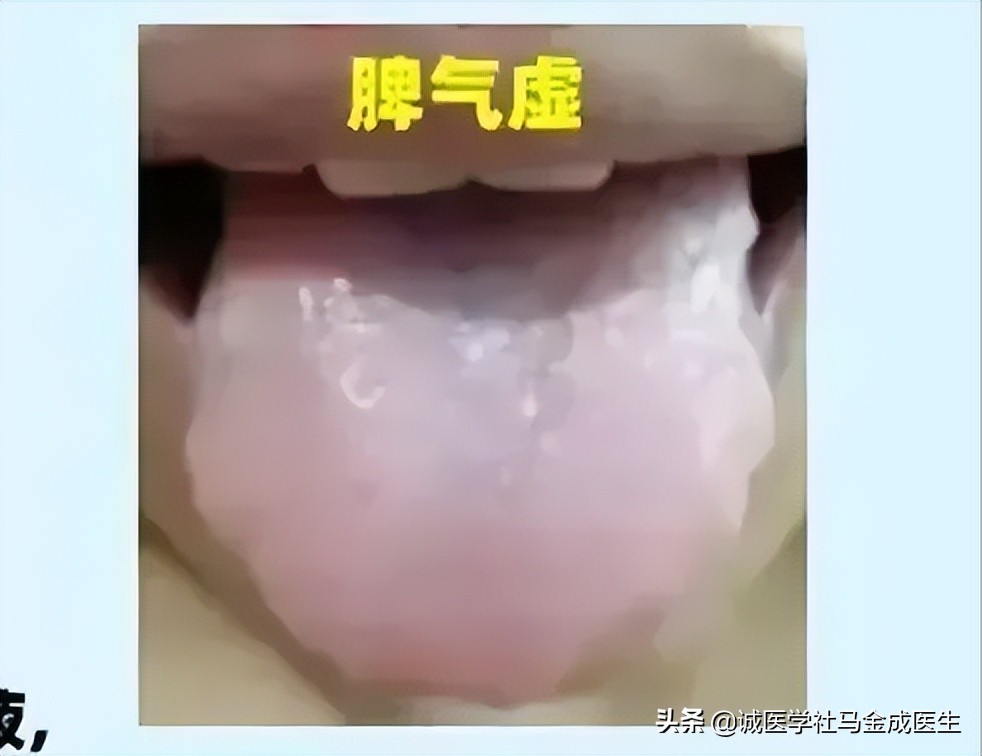 5岁小孩脾胃差吃什么中成药调理,脾胃肝肾肺亏损全部调理的中成药