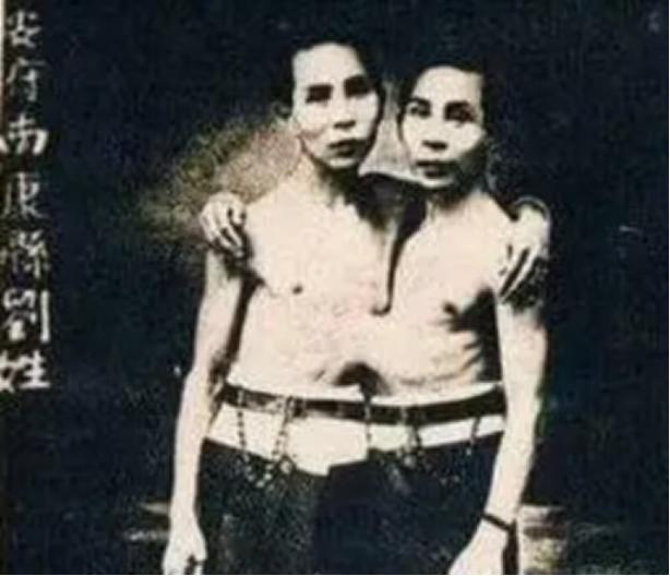 泰国连体兄弟娶美国姐妹,泰国连体兄弟娶双胞胎姐妹