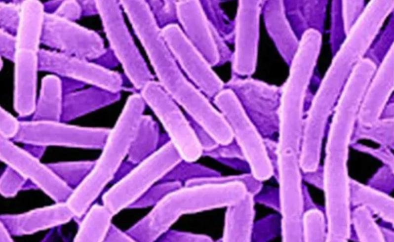 科学家复活潘多拉病毒 (人们为什么要复活潘多拉病毒)