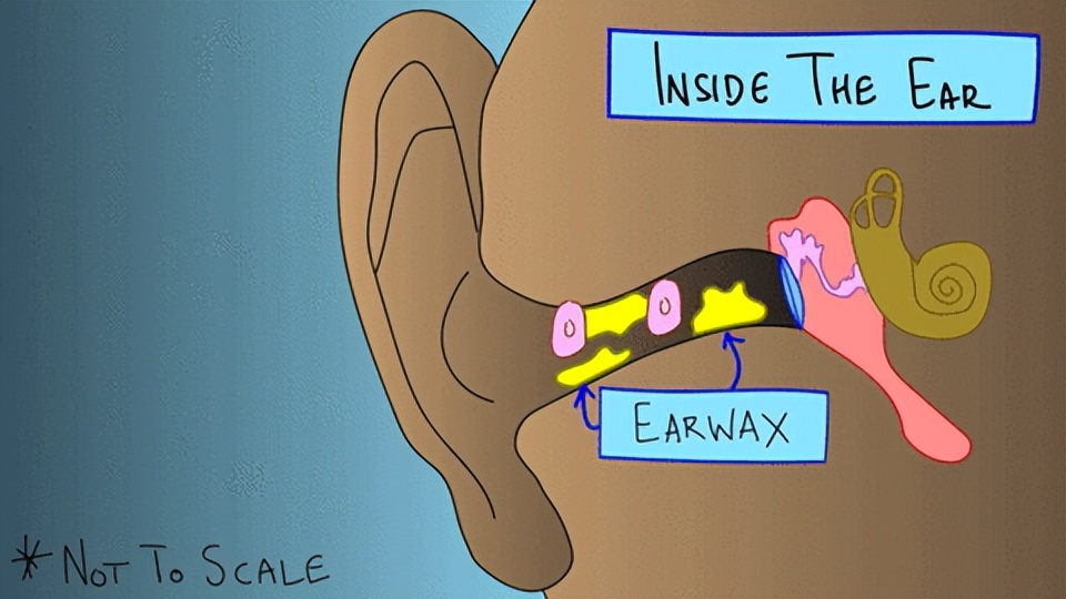 掏耳勺自己掏耳屎的正确方法,掏耳屎为什么这么舒服