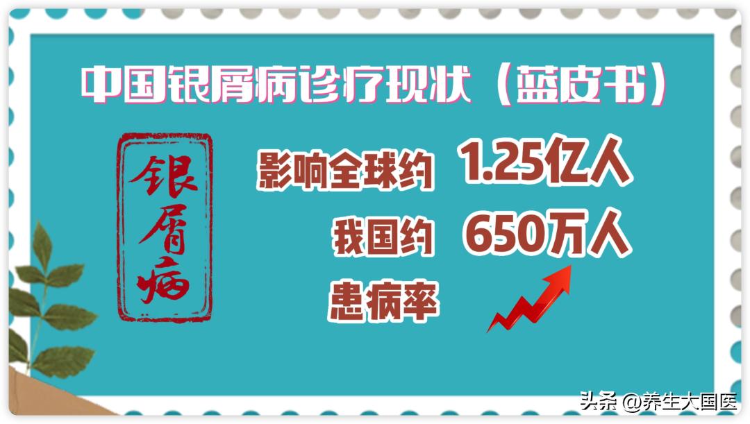专治银屑病的祖传秘方外用,中医治银屑病最新突破技术
