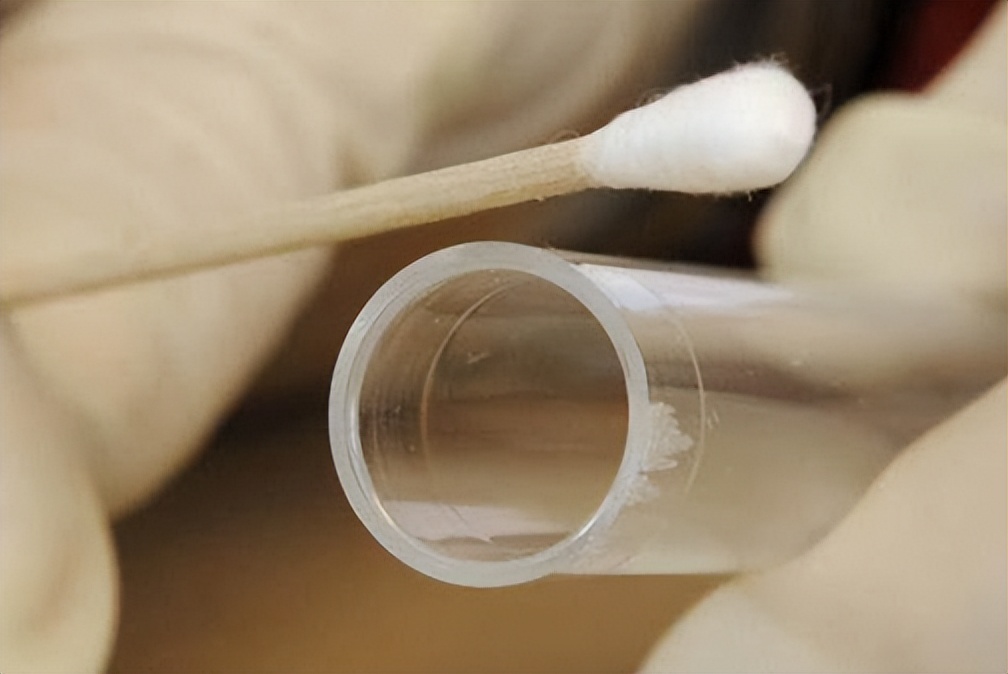 谁还敢提“严谨的日耳曼人”？2009年“棉签丑闻”，打脸德国警察