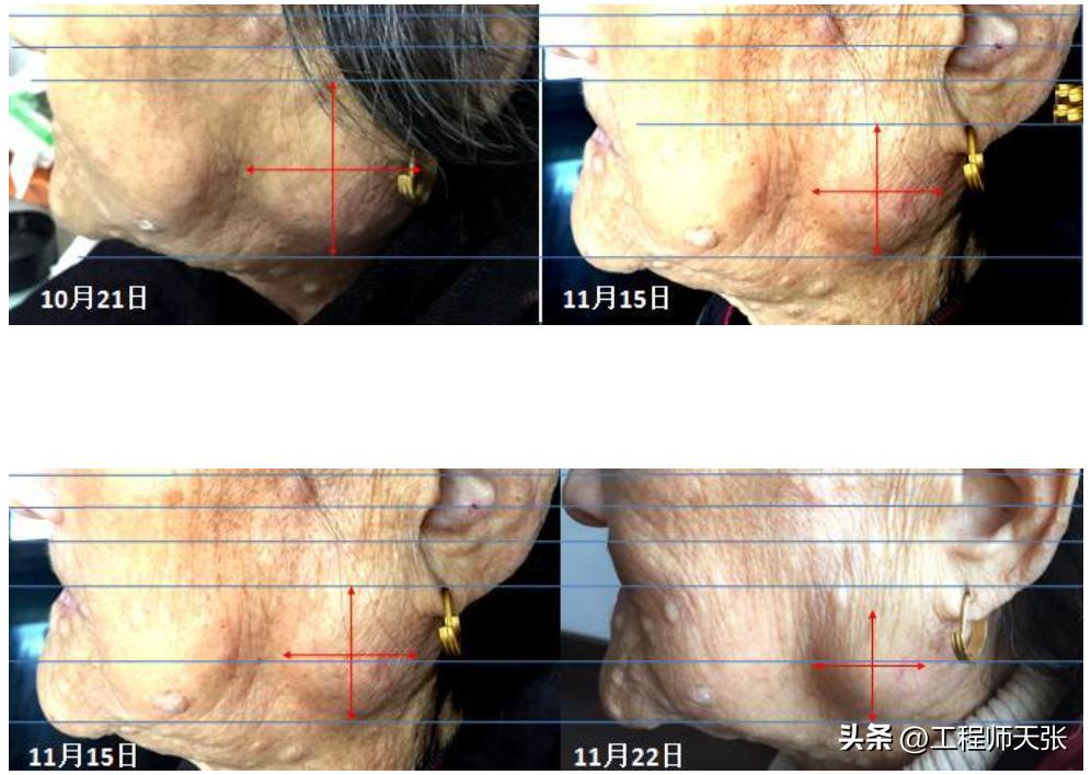 安徽“药神”秦才东，因治癌药获缓刑！牛津博士仍愿做科研个体户