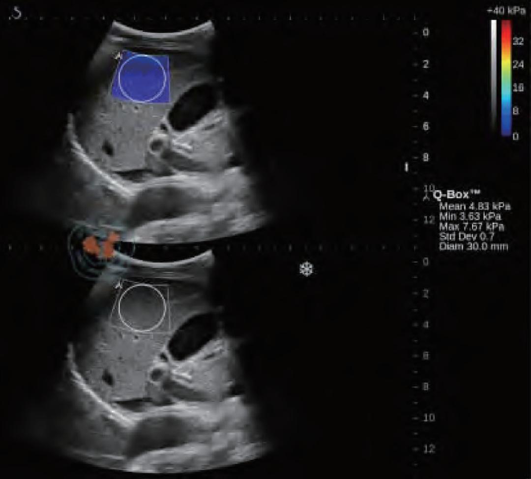 看不见的作用力,看不见的振动