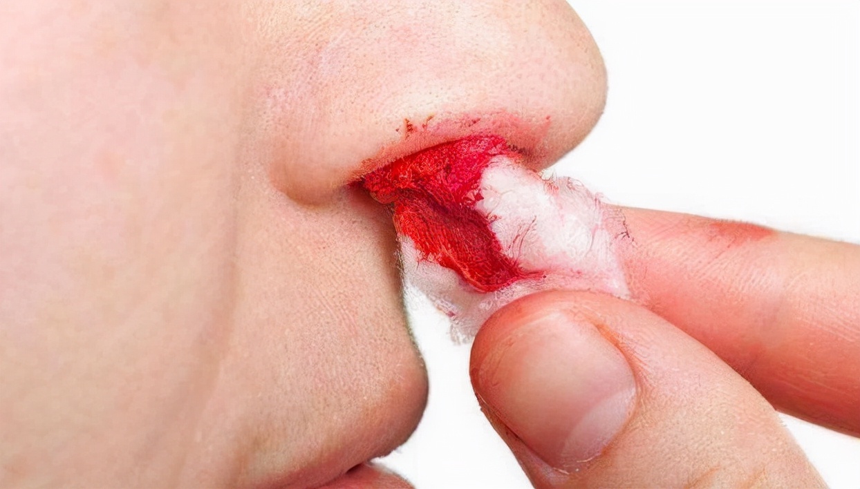 癌症转移时有哪些表现5个方法可预防