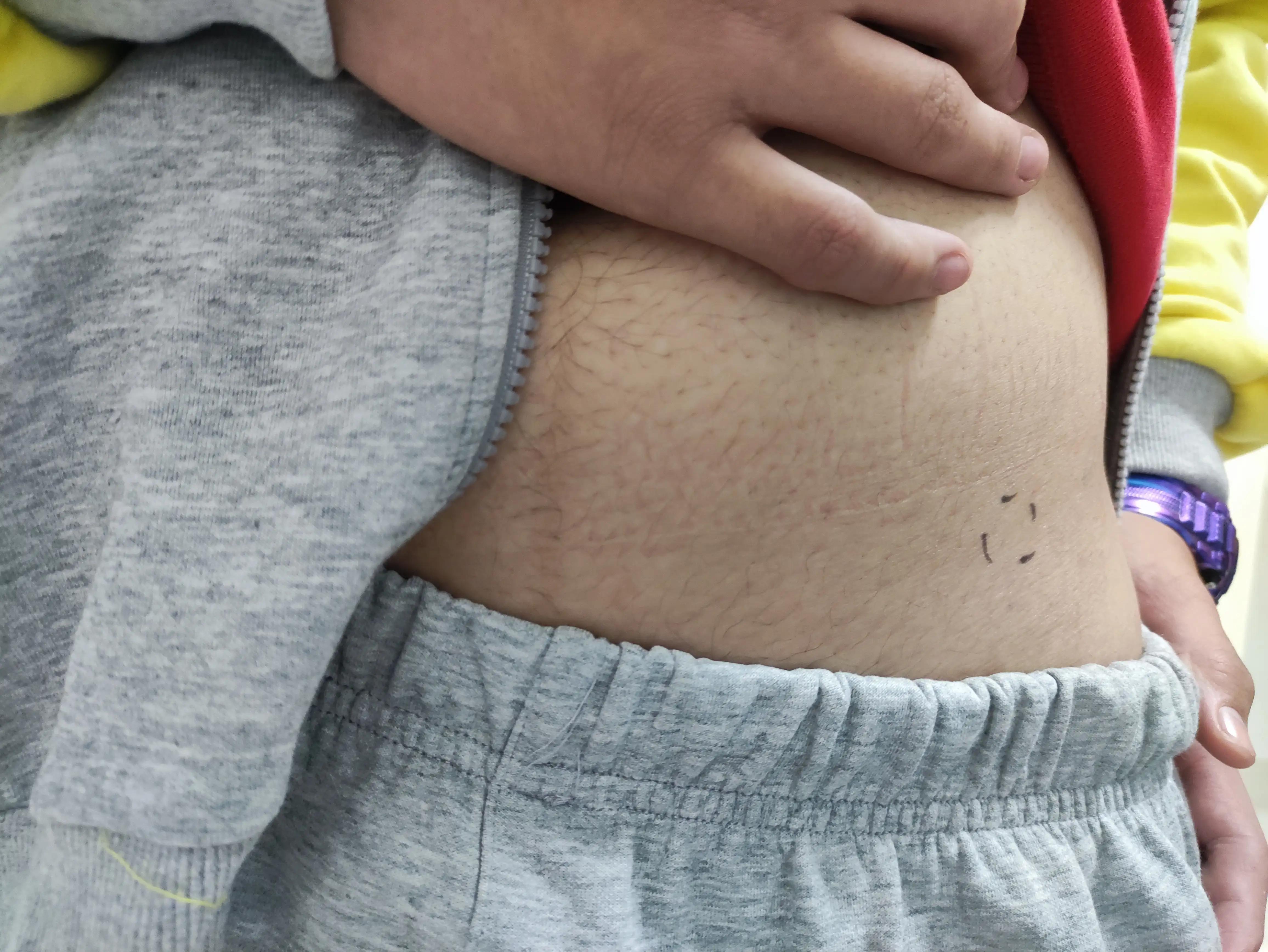 跑完步后大腿根骨头关节疼,跑完步走路大腿根部筋疼痛