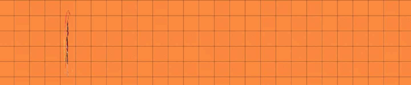 音乐治疗是一个系统的干预过程,音乐治疗中患者与音乐的关系