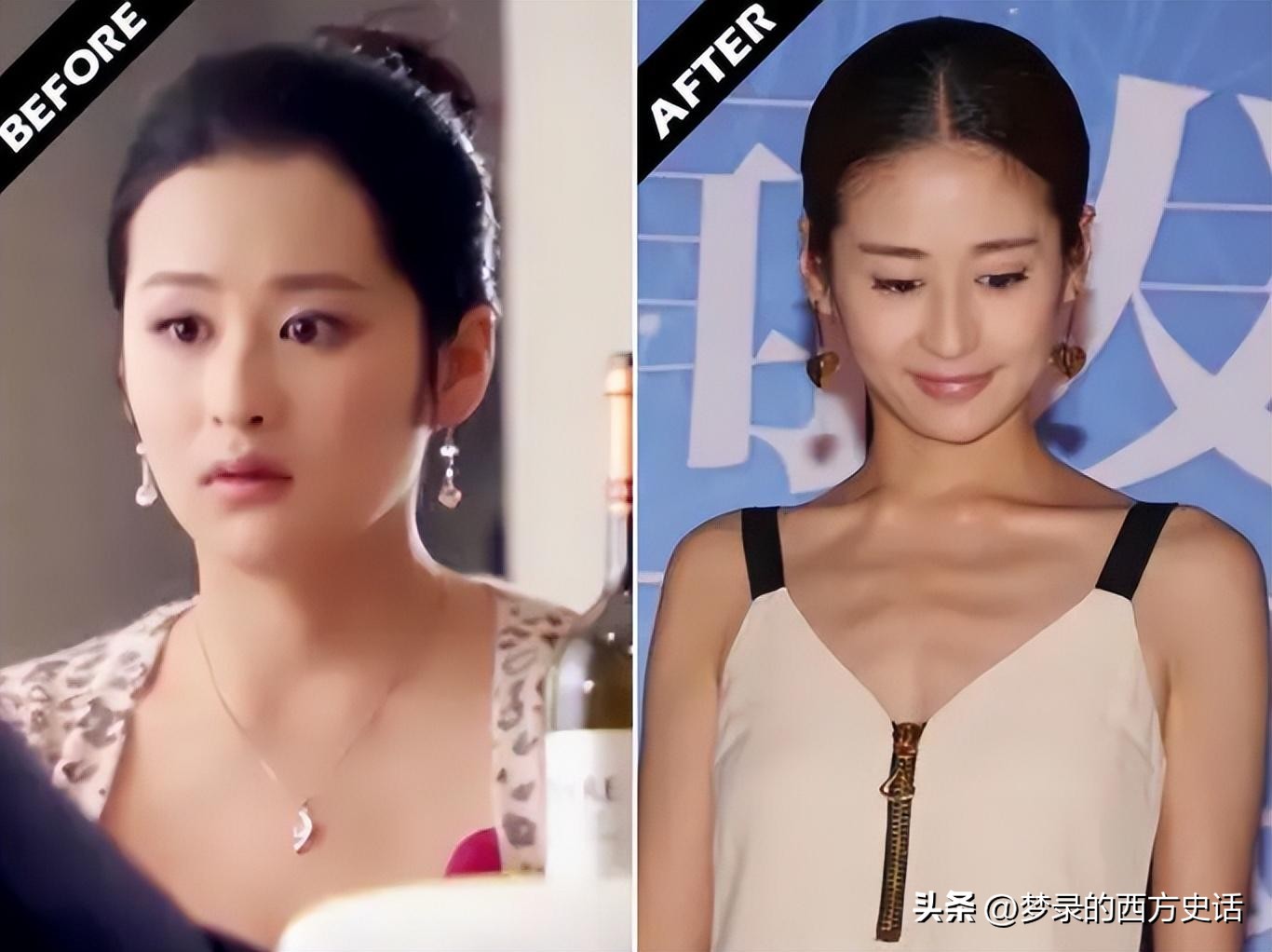 瘦成排骨、整容上瘾、强行装嫩，女明星的畸形审美何时休？