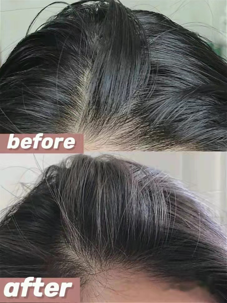 洗发水红榜推荐控油蓬松欧莱雅,洗发水红榜控油滋润