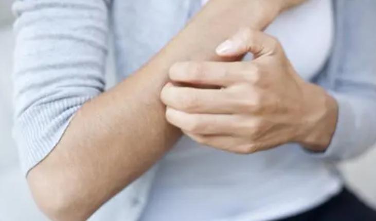 中医药膏治小儿湿疹,中药外敷治湿疹越敷越严重