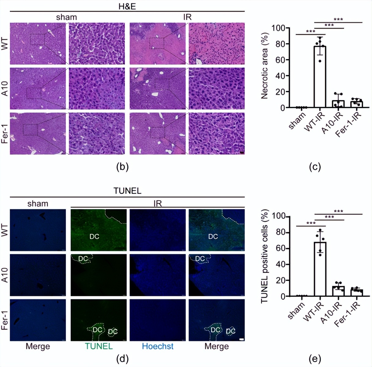 research最新研究进展,大鼠肝缺血再灌注损伤