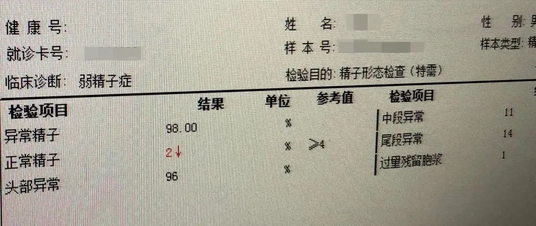 【科普】志愿者精子合格率不到20%！这届男人“不行”？这项检查别错过