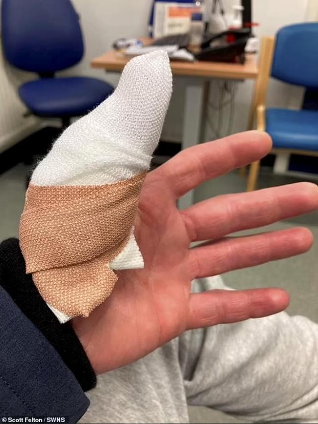 英国嗜血松鼠2天咬伤18人咬到出血!最终被抓起来安乐死