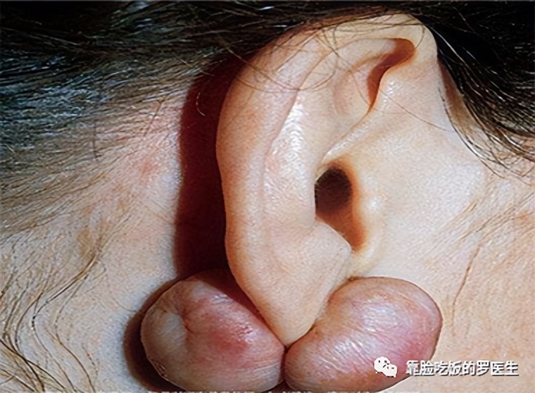 科普疤痕知多少,瘢痕科普视频