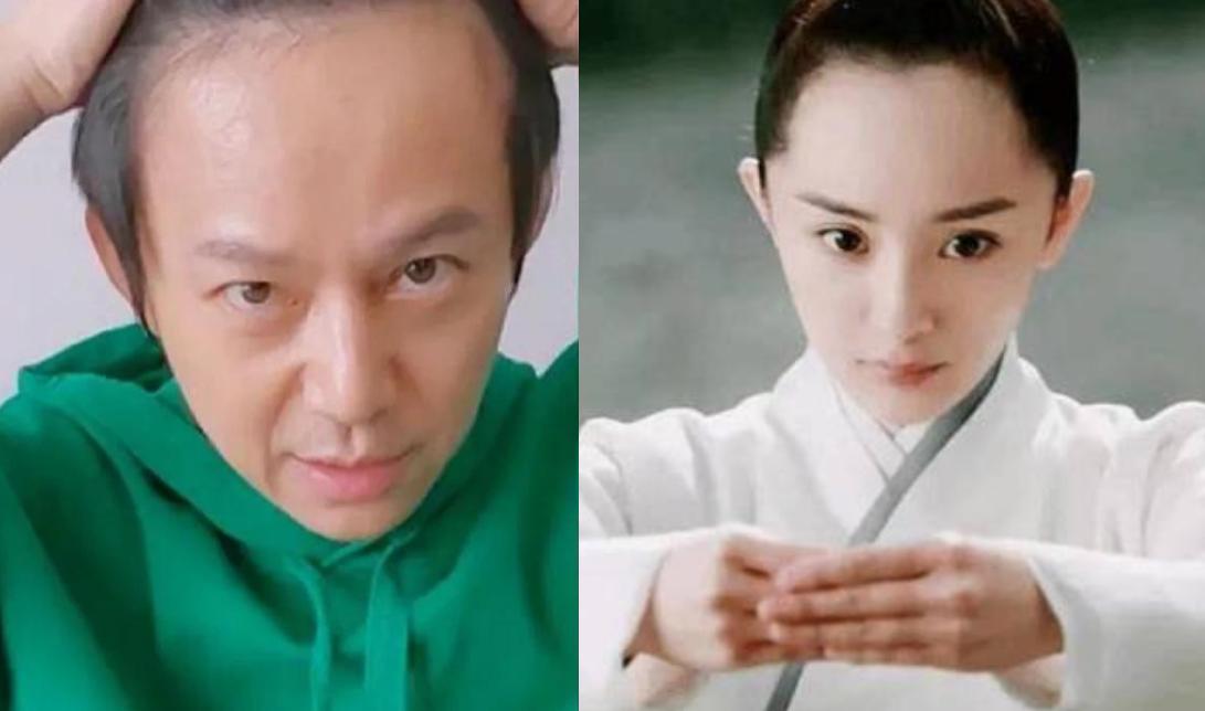 发际线秃的男星,盘点十大秃头男星佩戴假发