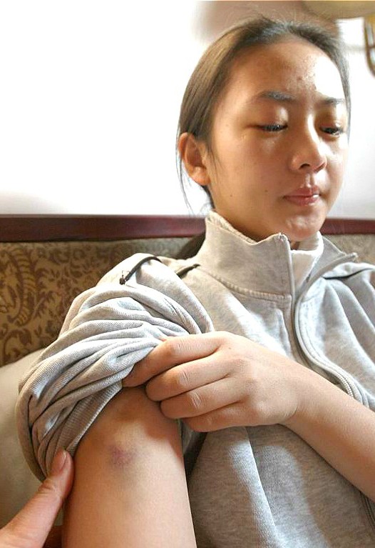 童瑶被张默打后如何翻身,童瑶为什么被张默暴打后续