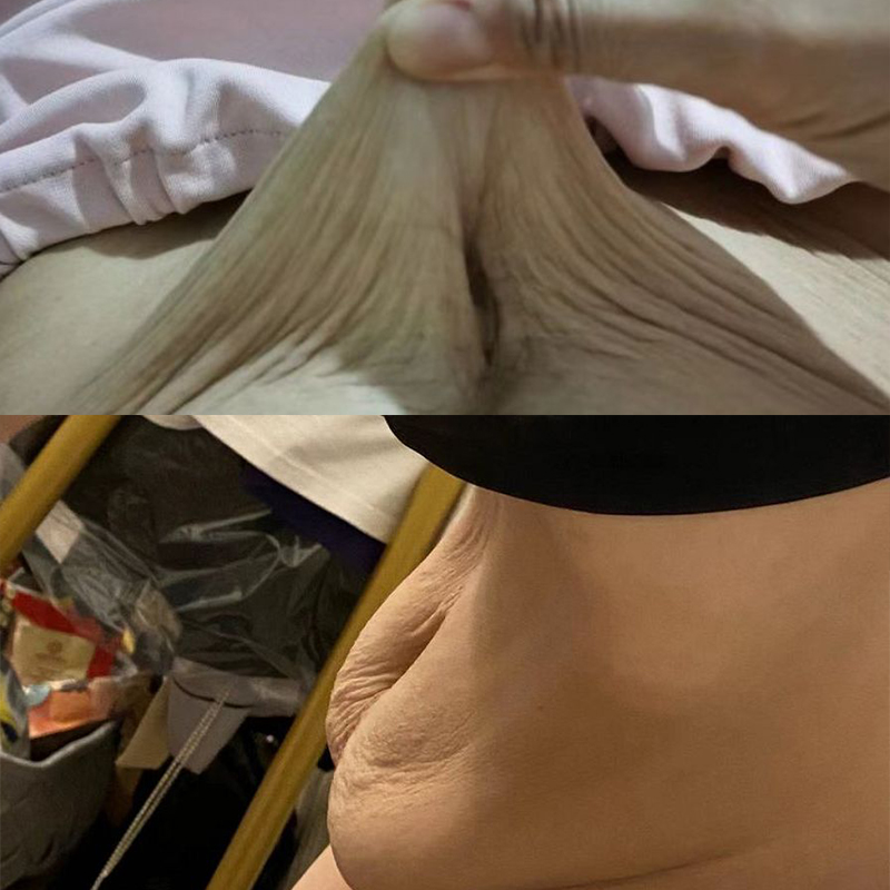 产后肚皮松松垮垮怎么练,产后肚皮松松垮垮怎么办啊