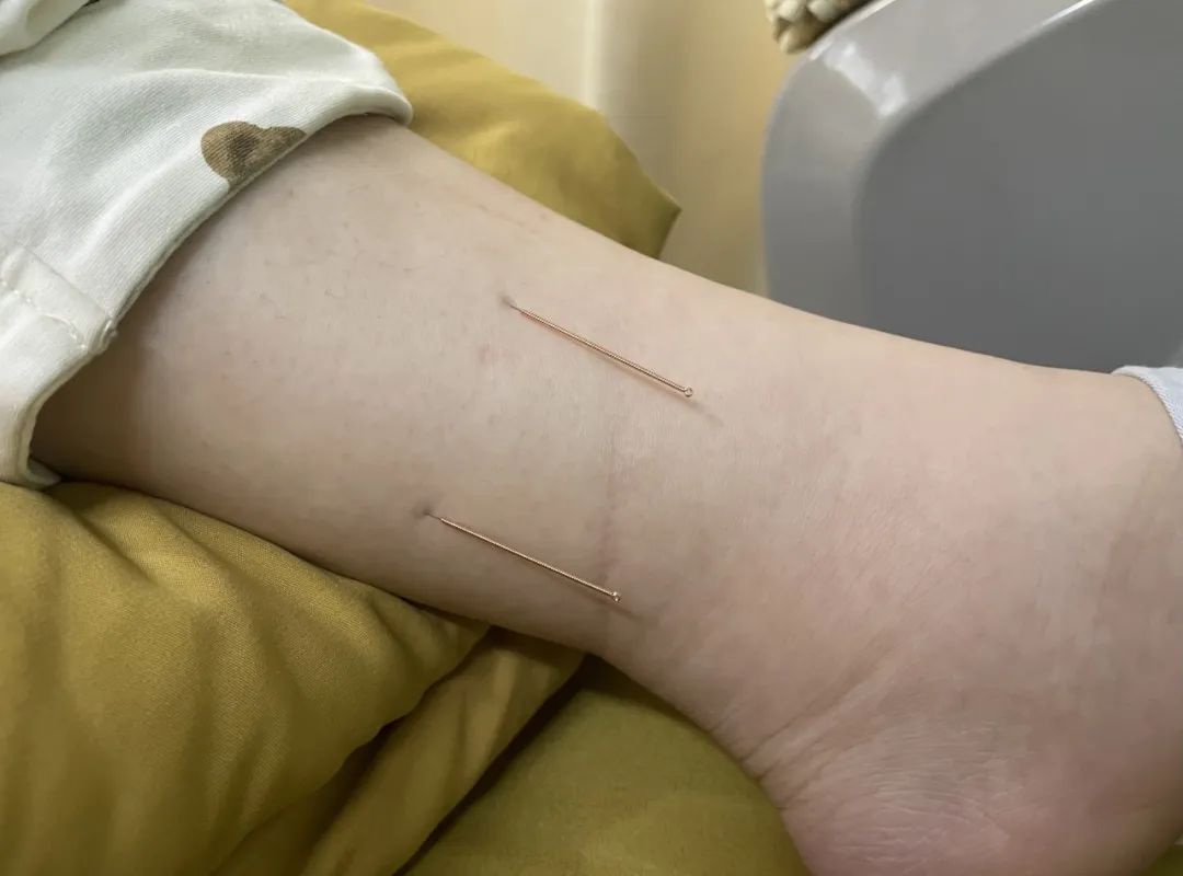 产后宫缩痛得睡不着怎么办,产后宫缩痛的不行能吊水吗