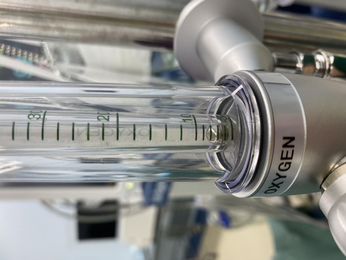 高流量吸氧感受,高流量吸氧技术是什么