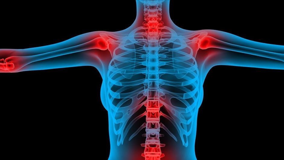 终身无法治愈的十种骨科病,骨科医生的10个忠告记住了