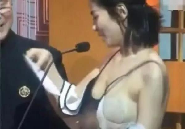 刘涛为什么不填充法令纹,刘涛法令纹怎么去除的