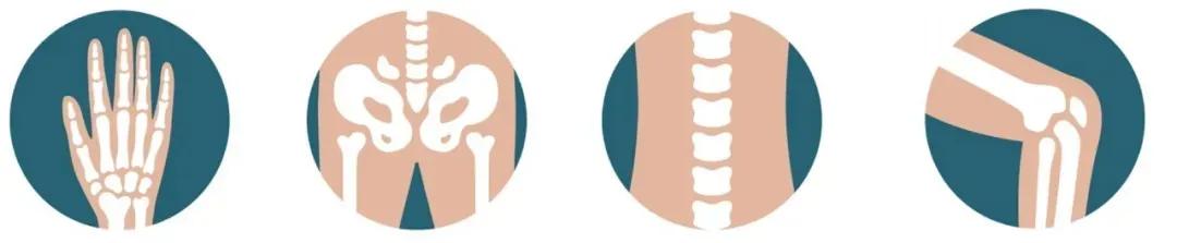 了解：骨性关节炎的康复治疗