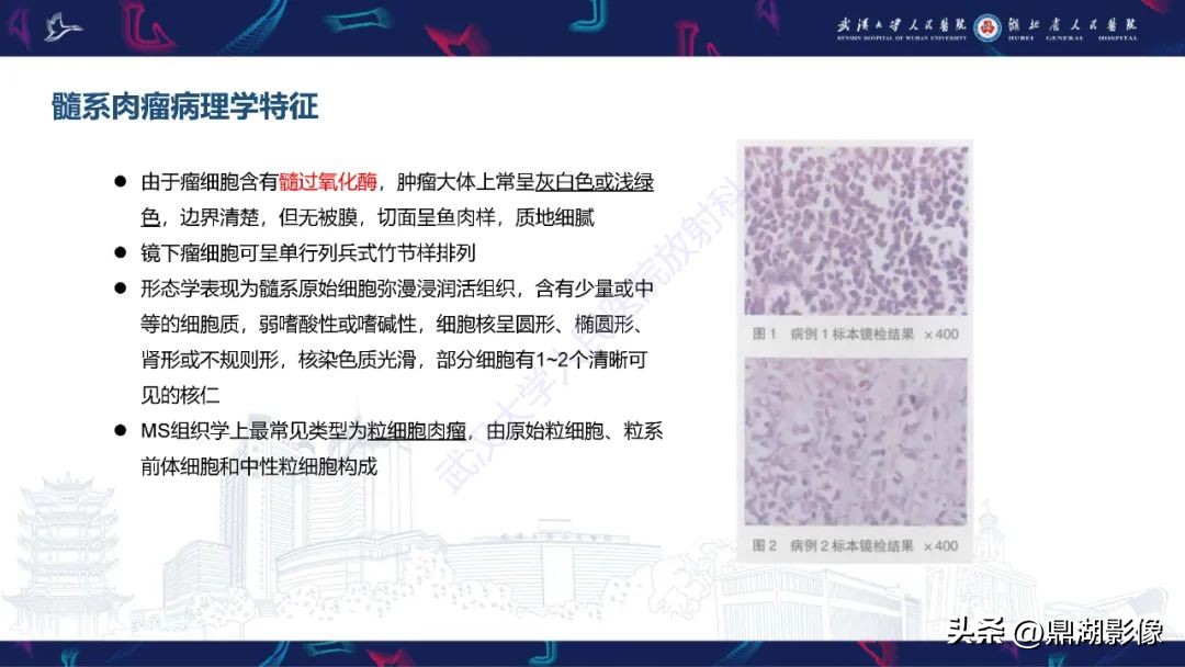 阴道里长肉瘤是啥症状,阴道肉瘤症状
