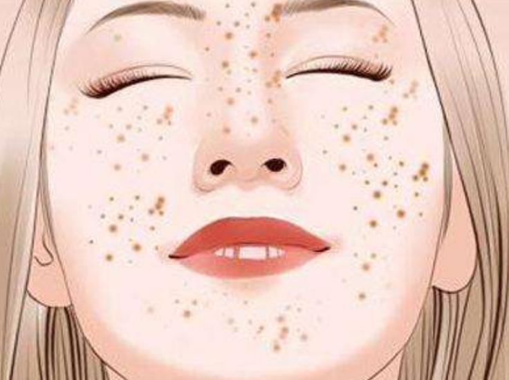 调理脸上蜡黄长斑食谱,青褐斑的中医调理