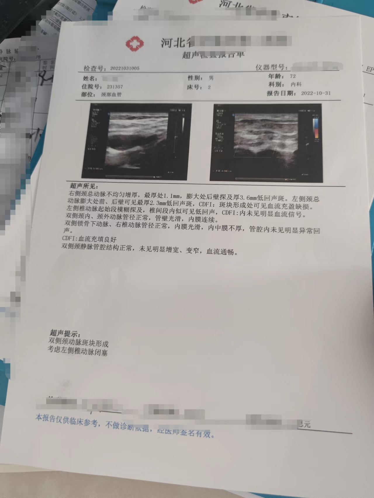 一例头晕，眼睛看东西模糊患者的会诊