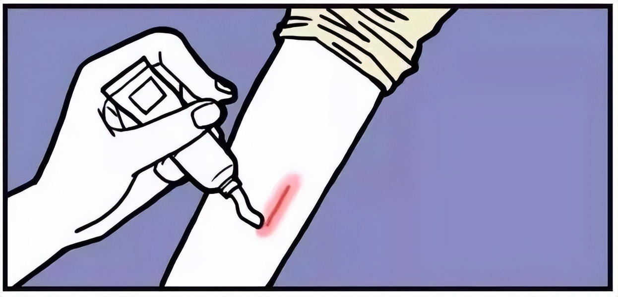 什么方法除疤最好,关于祛疤的一些小妙招