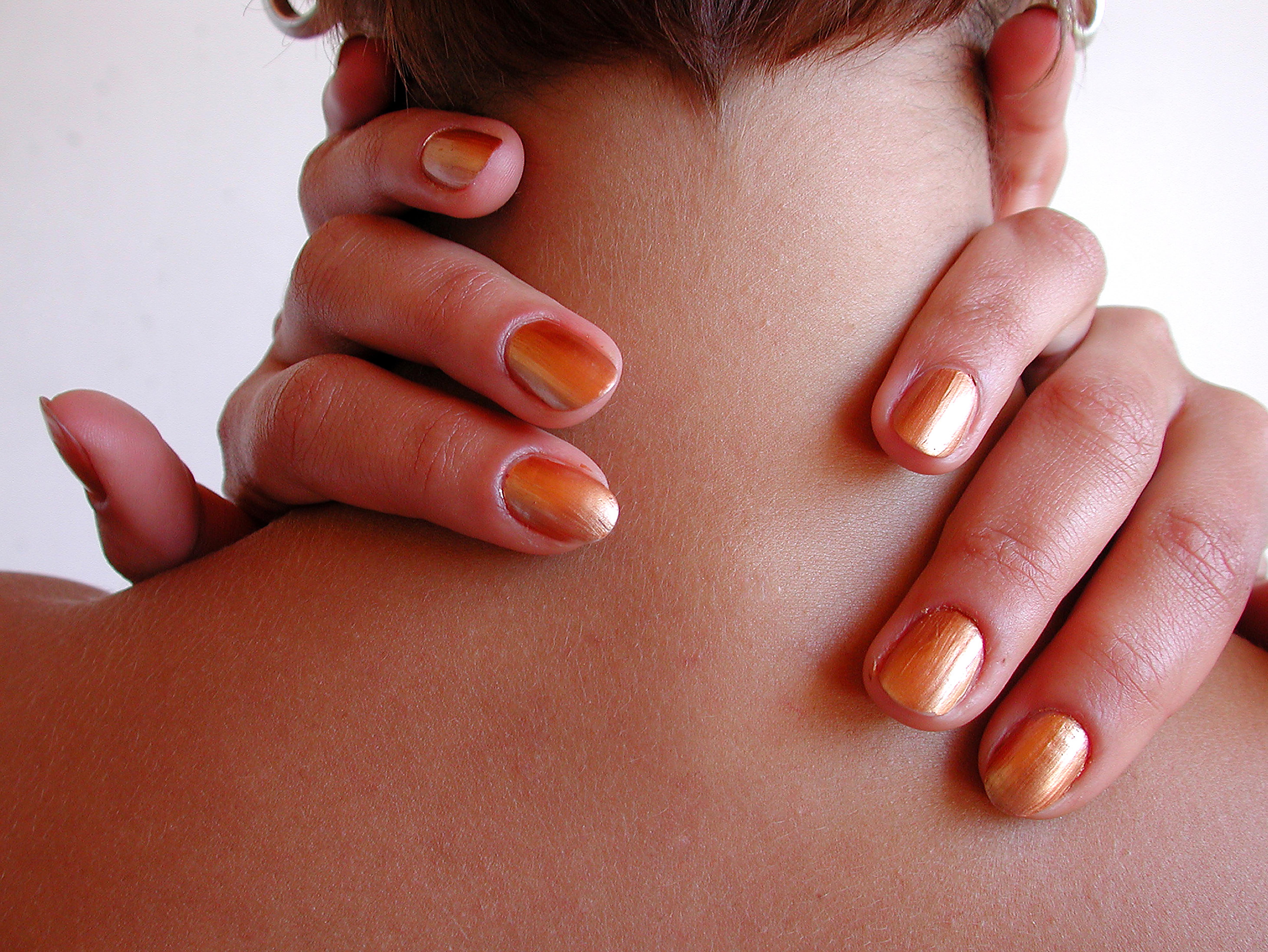 点痣后面会不会留疤一脸都点了,点痣之后会留坑