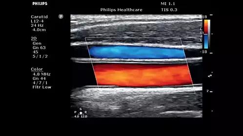 飞利浦philipscvr708,飞利浦philipsspt6627测评