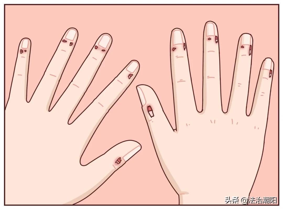 手指长倒刺缺乏哪种维生素,宝宝手指倒刺是缺什么维生素